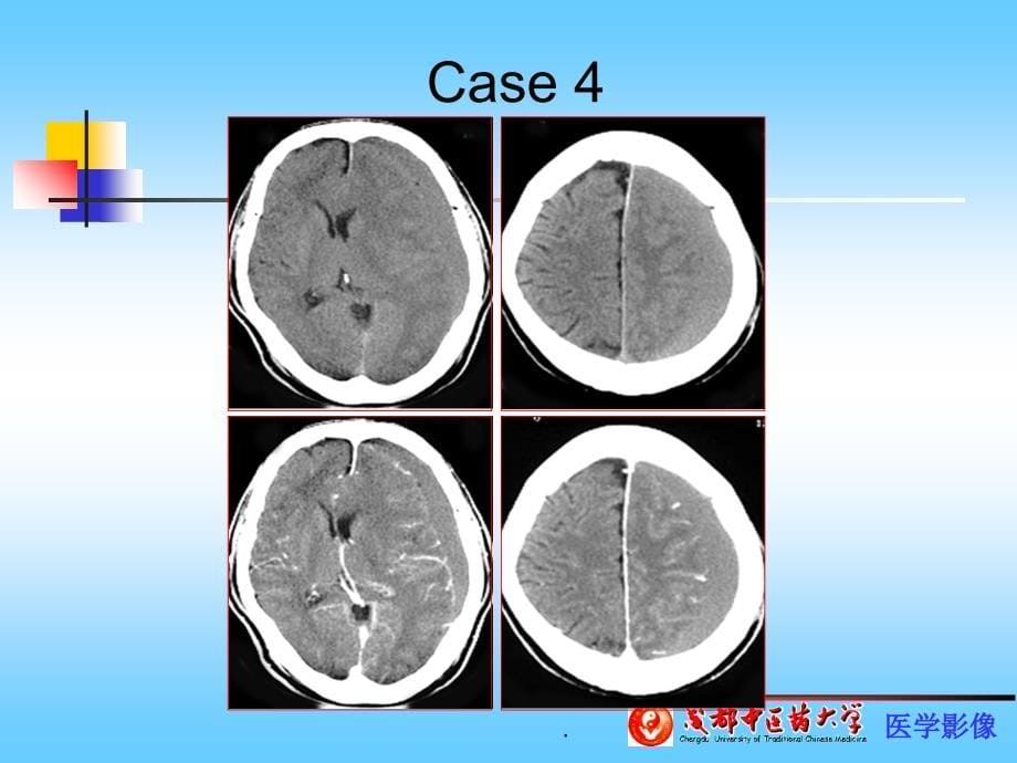 CT病例分析ppt课件_第5页