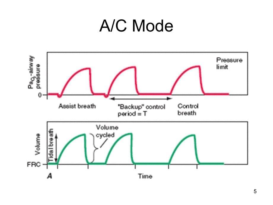 （优质医学）呼吸机常见模式及参数设置_第5页