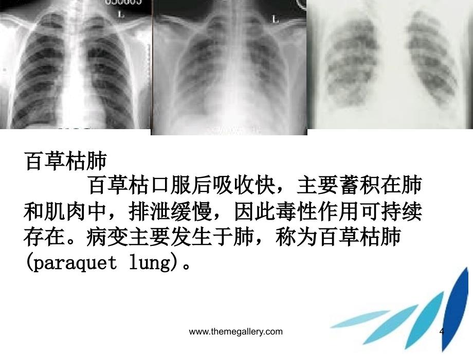 百草枯中毒的护理查房幻灯片_第4页