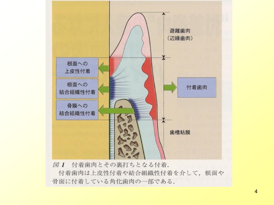 牙周手术治疗幻灯片_第4页
