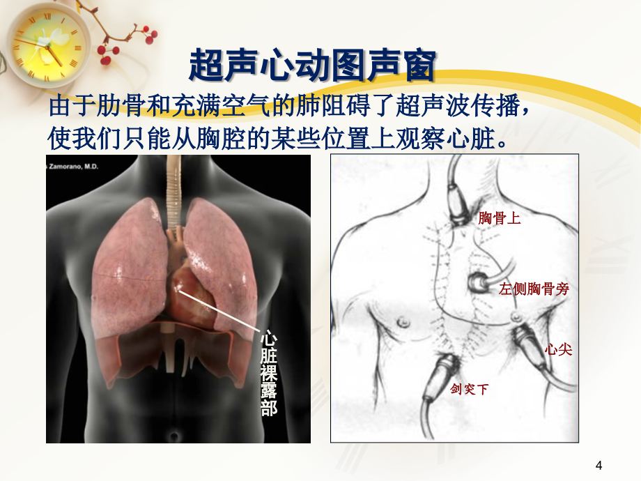 心脏超声常用切面及解剖PPT参考课件_第4页