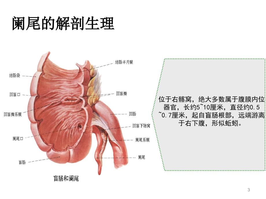 阑尾炎腹腔镜术前术后护理幻灯片_第3页