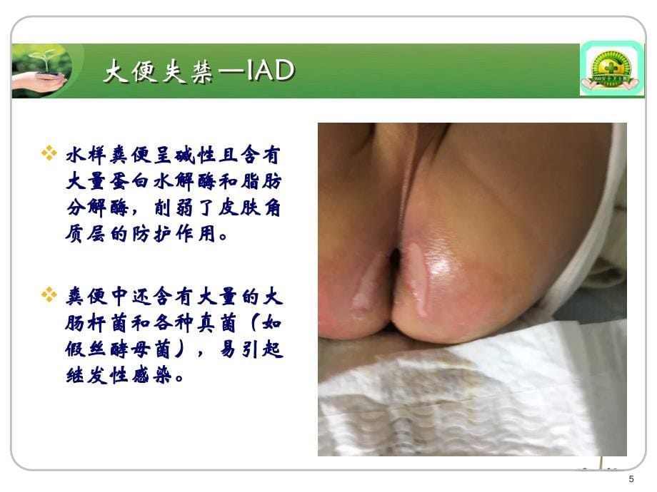 （优质医学）失禁性皮炎护理学习课件_第5页