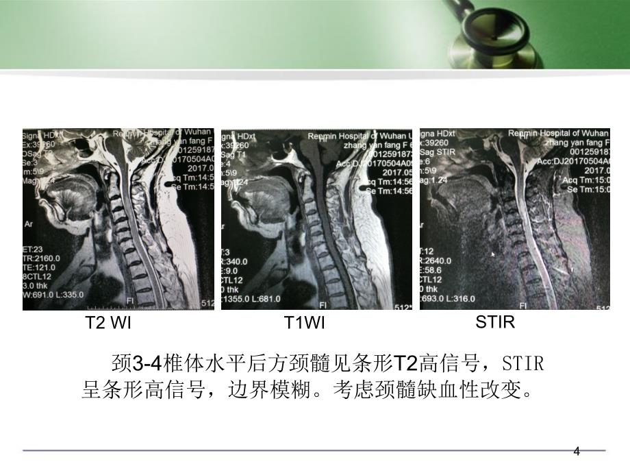 MRI诊断入门病例演示课件_第4页