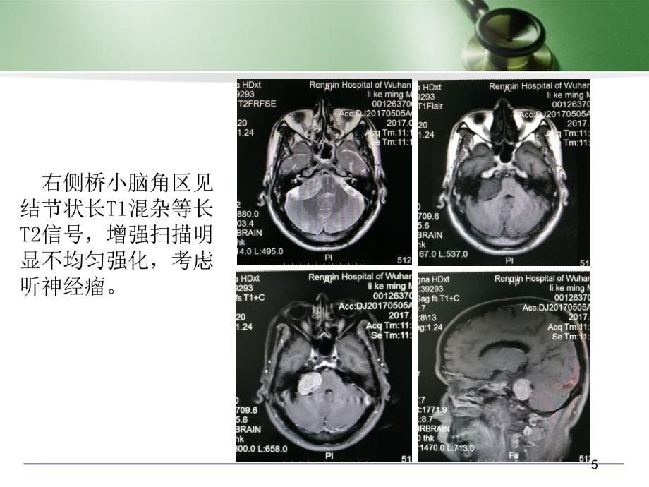 MRI诊断入门病例演示课件_第5页