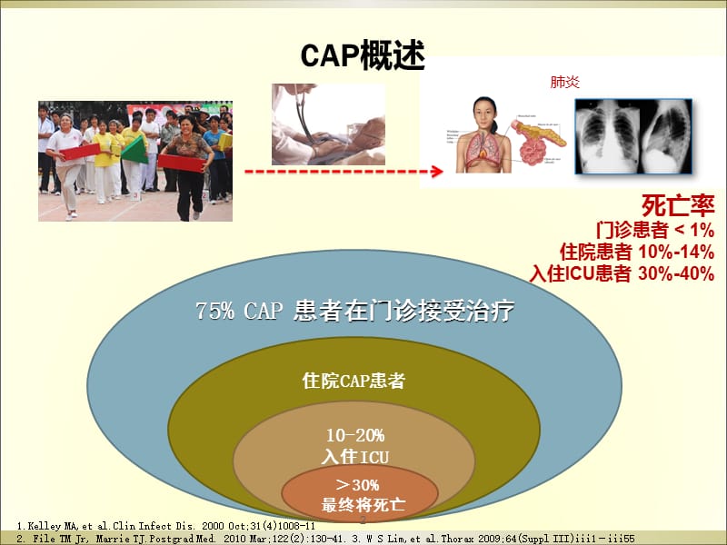 社区获得性肺炎(CAP)严重程度评价及抗生素的使用幻灯片_第2页