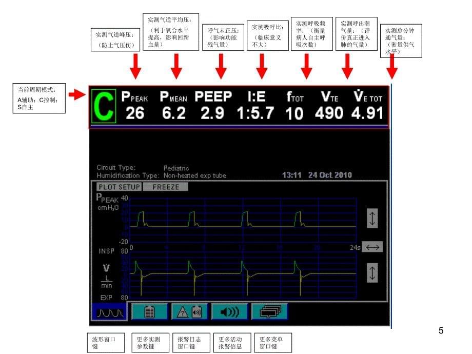 PB840 呼吸机讲解幻灯片_第5页