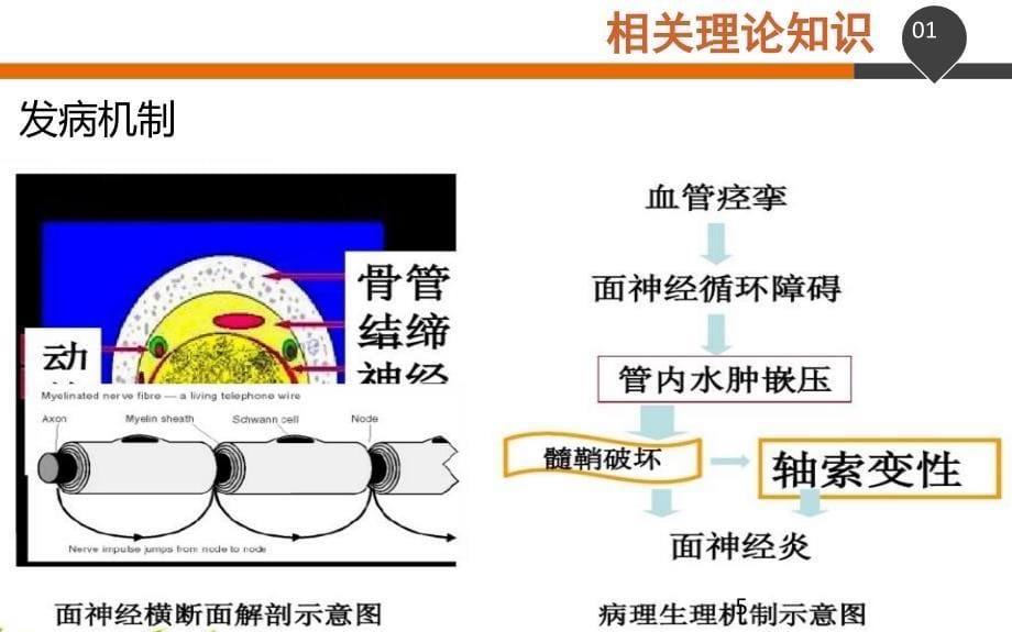 面神经炎患者的护理查房演示课件_第5页