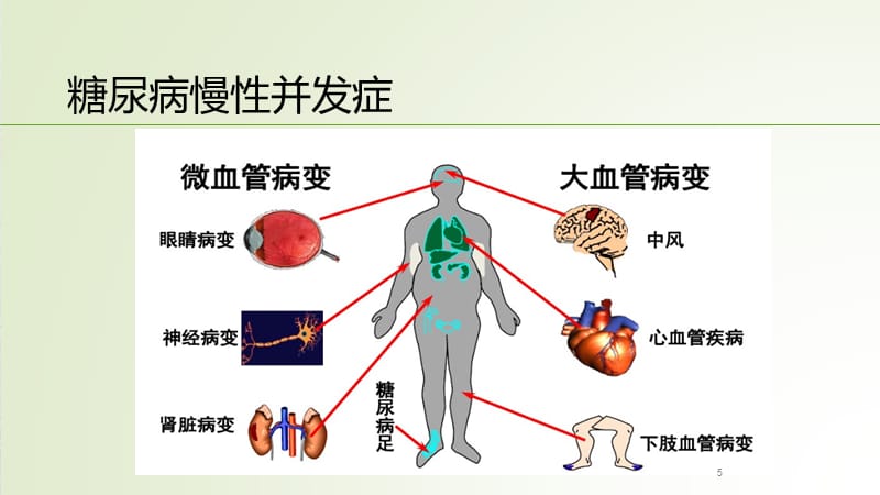 SGLT2抑制剂在糖尿病中的应用PPT参考课件_第5页