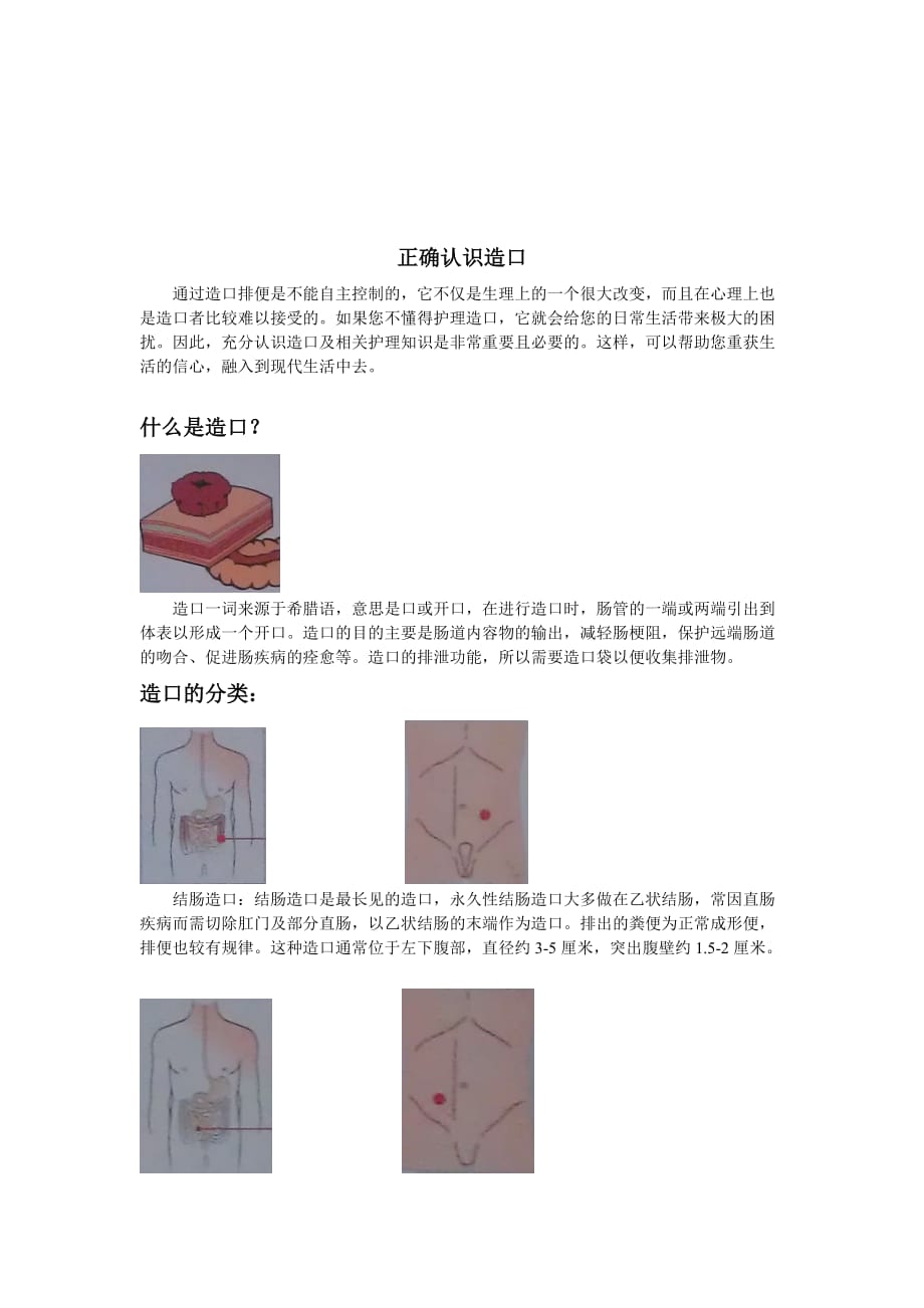 泌尿外科科普知识-_第3页