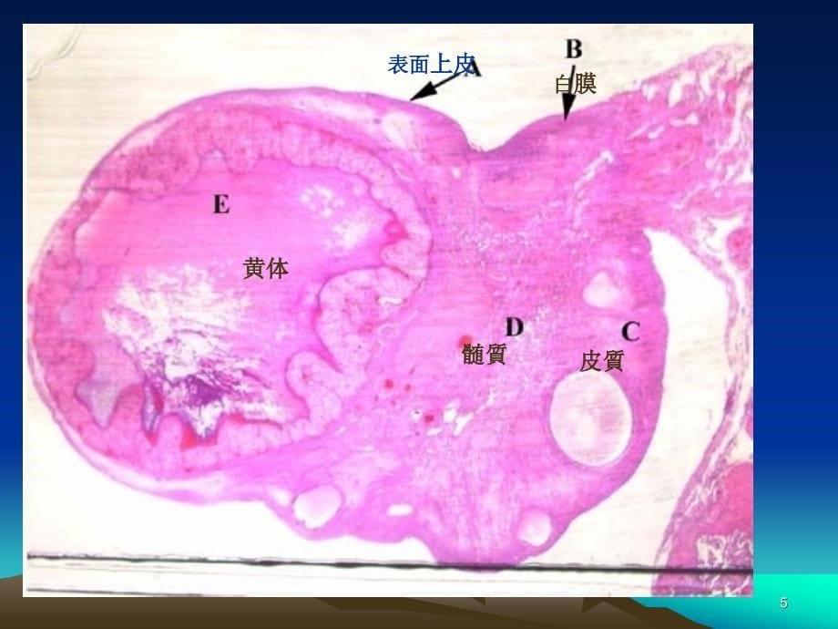 （优质医学）女性生殖器系_第5页