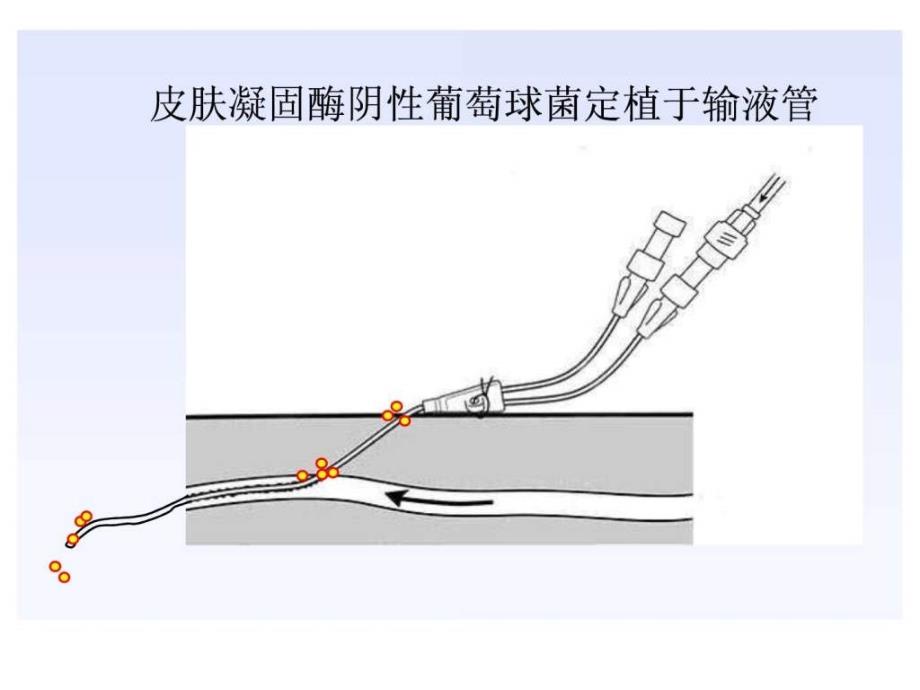 明确血培养的临床意义课件_第3页