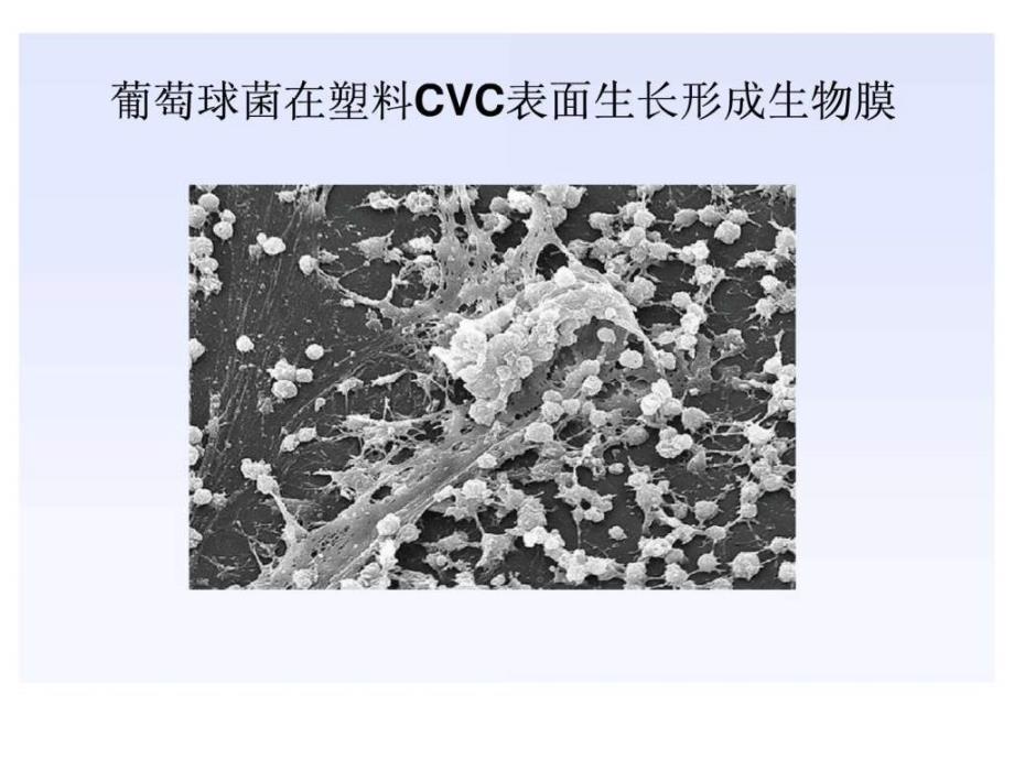 明确血培养的临床意义课件_第4页