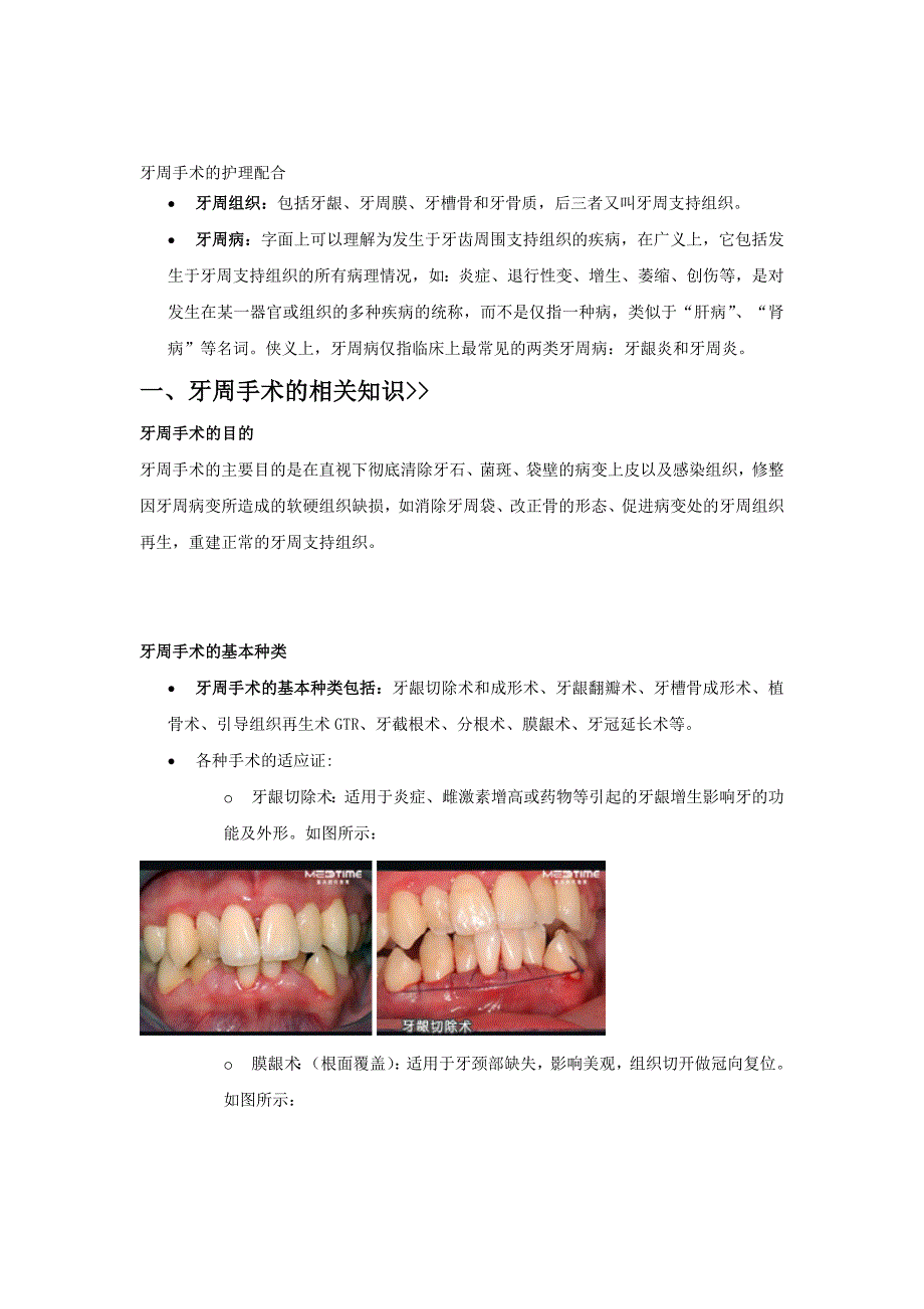 牙周PPT资料_第1页