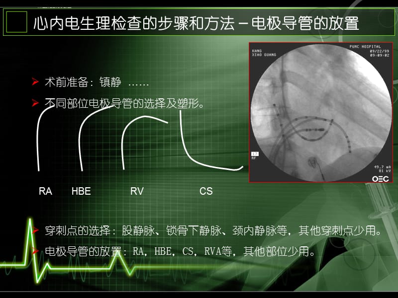 心内电生理检查方法及基本概念课件_第3页