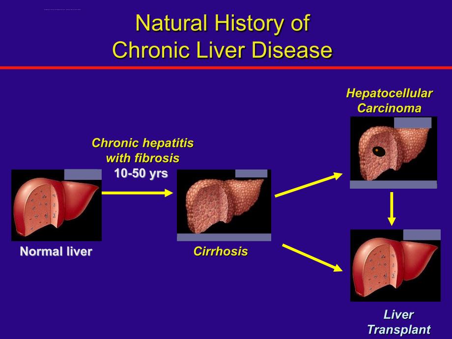 慢性肝病和肝纤维化-尤 红课件_第3页