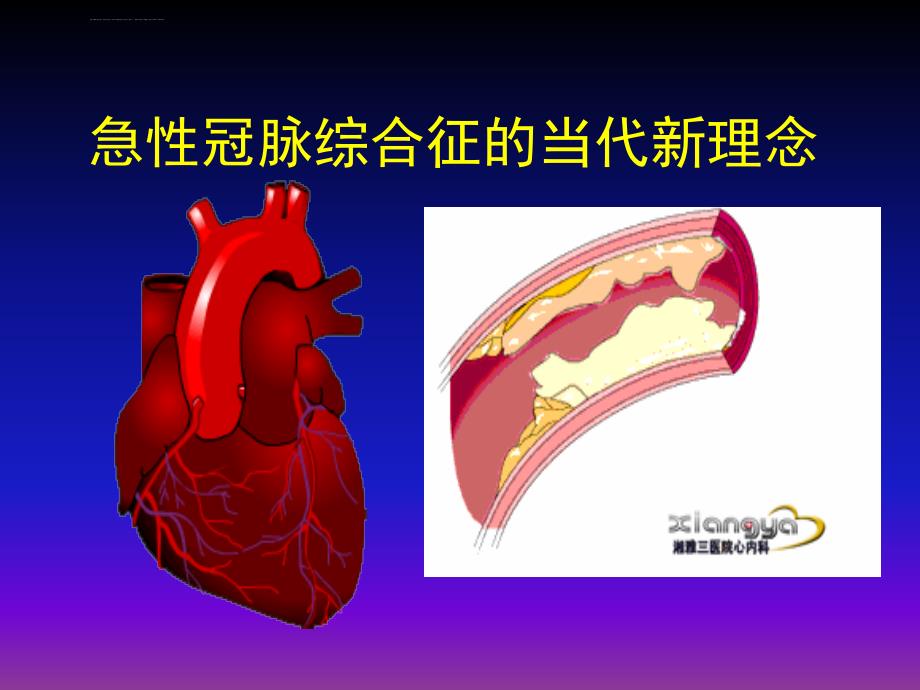 急性冠脉综合征的当代新理念（讲稿）课件_第1页