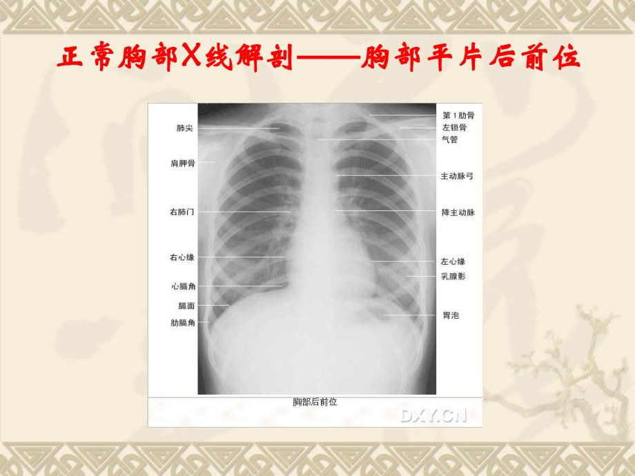 {精品}正常头颅X线解剖——头颅平片后前位_第3页