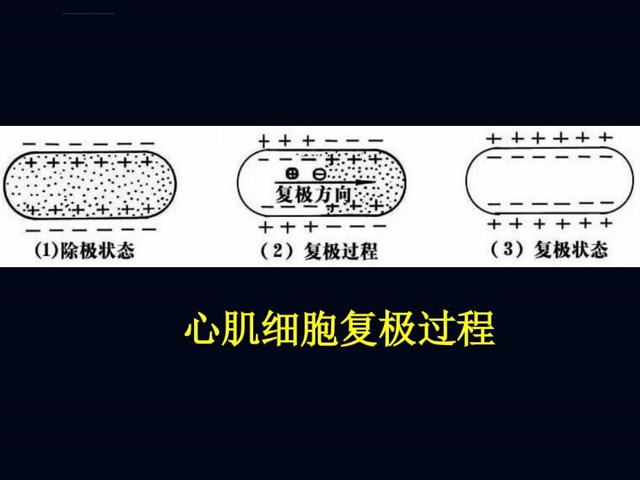 心电图诊断讲座课件_第5页