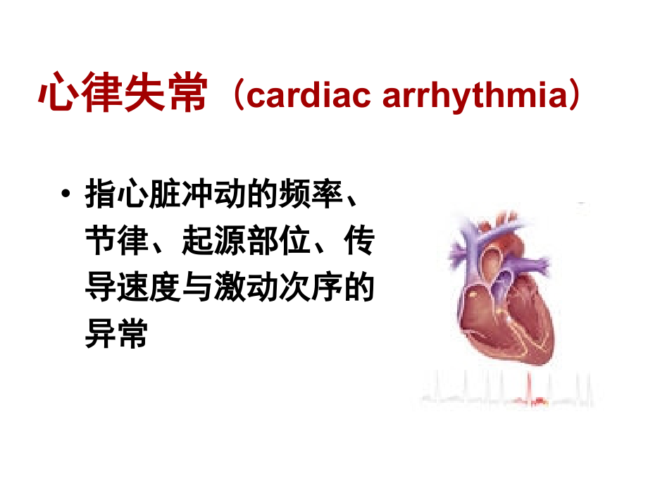 {实用文档}心律失常课件._第2页