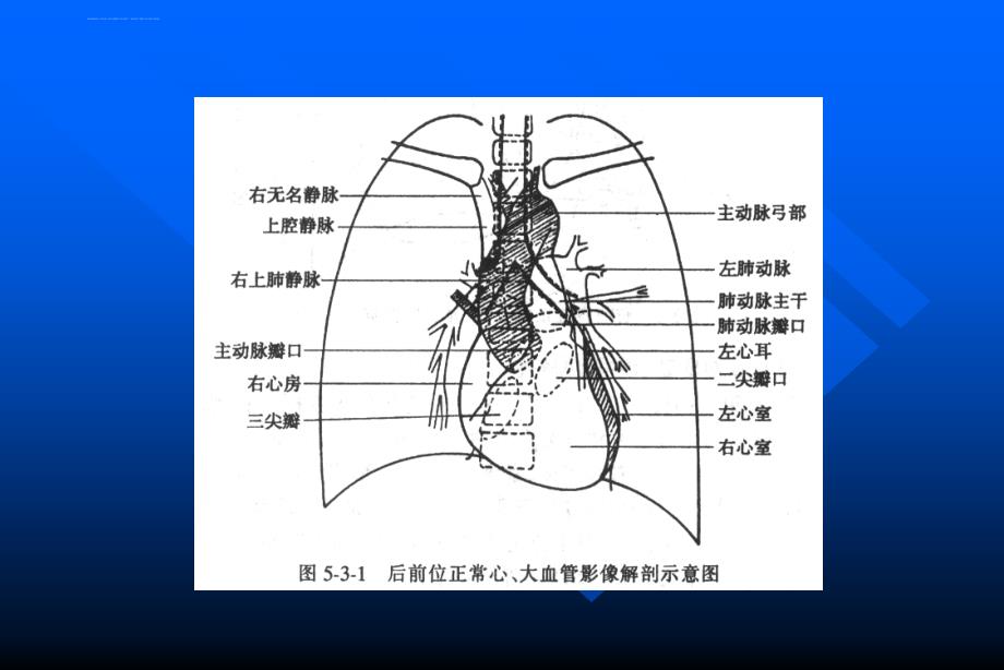 循环系统 影像诊断实习课件_第3页