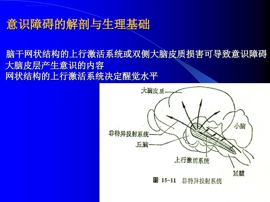 意识障碍1月18日课件_第4页