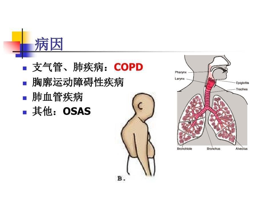 新版肺心病病人的护理课件_第5页