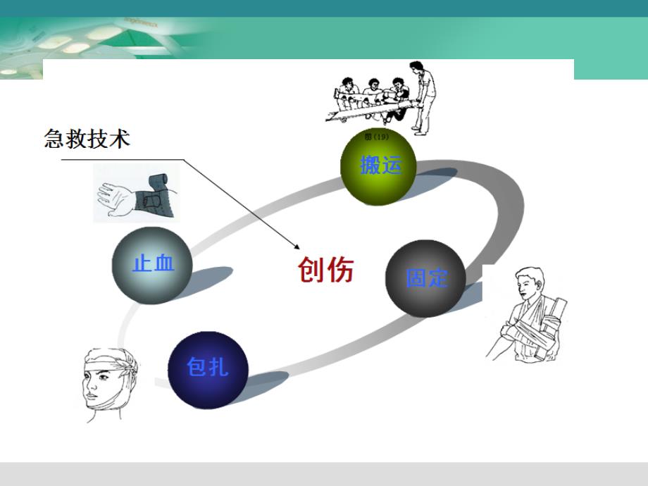 止血、包扎、固定、搬运术._第2页