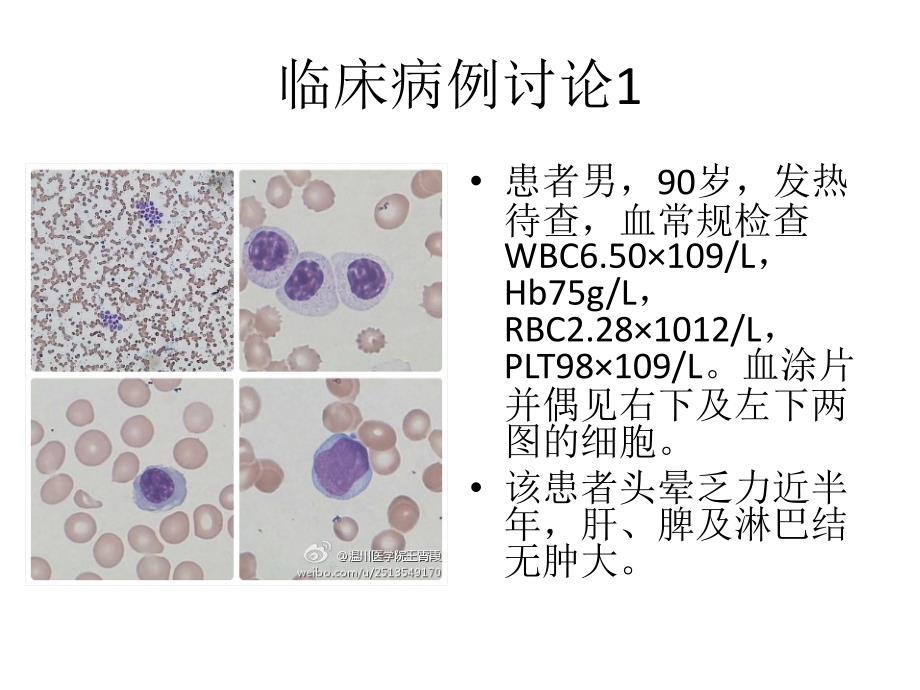 血涂片病例集合课件_第3页