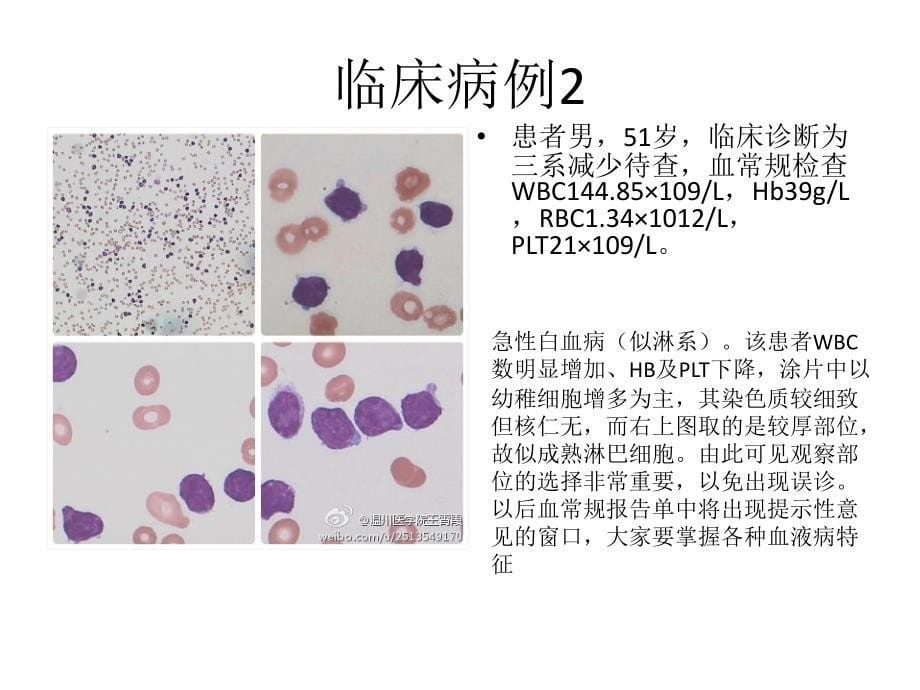 血涂片病例集合课件_第5页