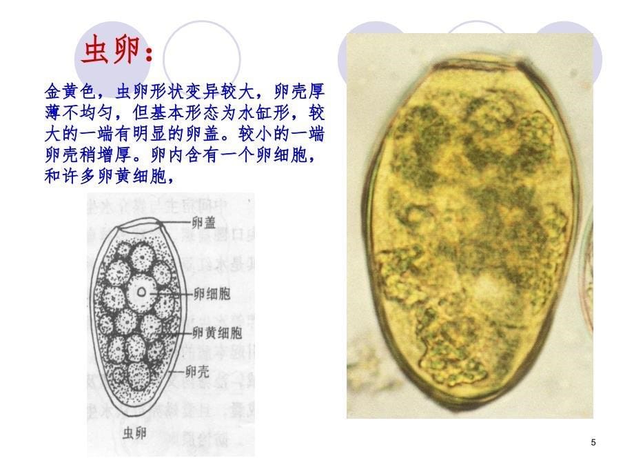 023-肺吸虫PPT演示课件_第5页