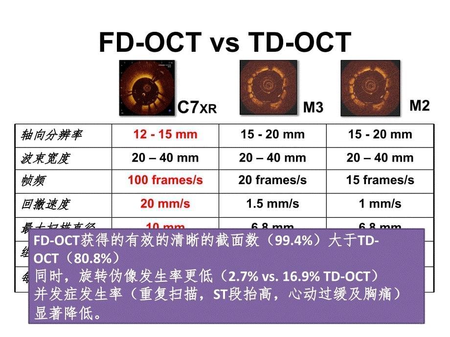 OCT在介入治疗中的应用(于波)PPT演示课件_第5页