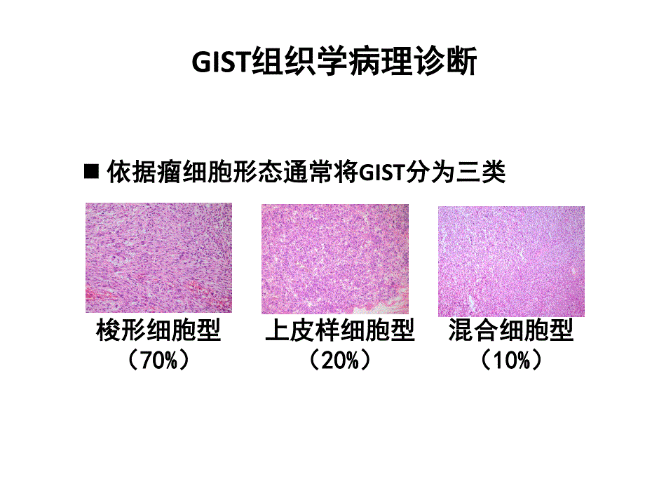 GIST诊断标准与预后评估_第4页