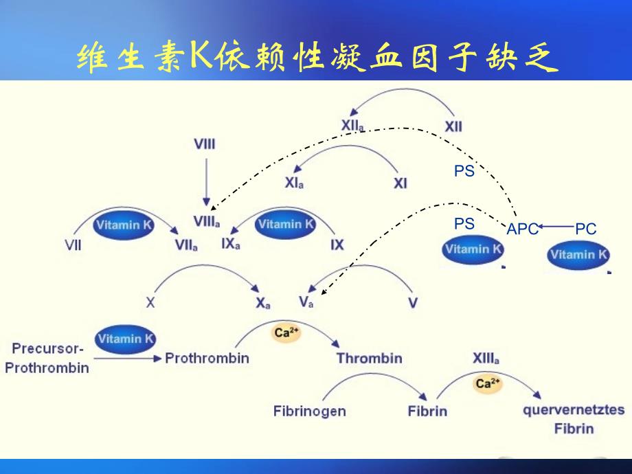 获得性凝血因子缺乏huiyi.ppt_第3页