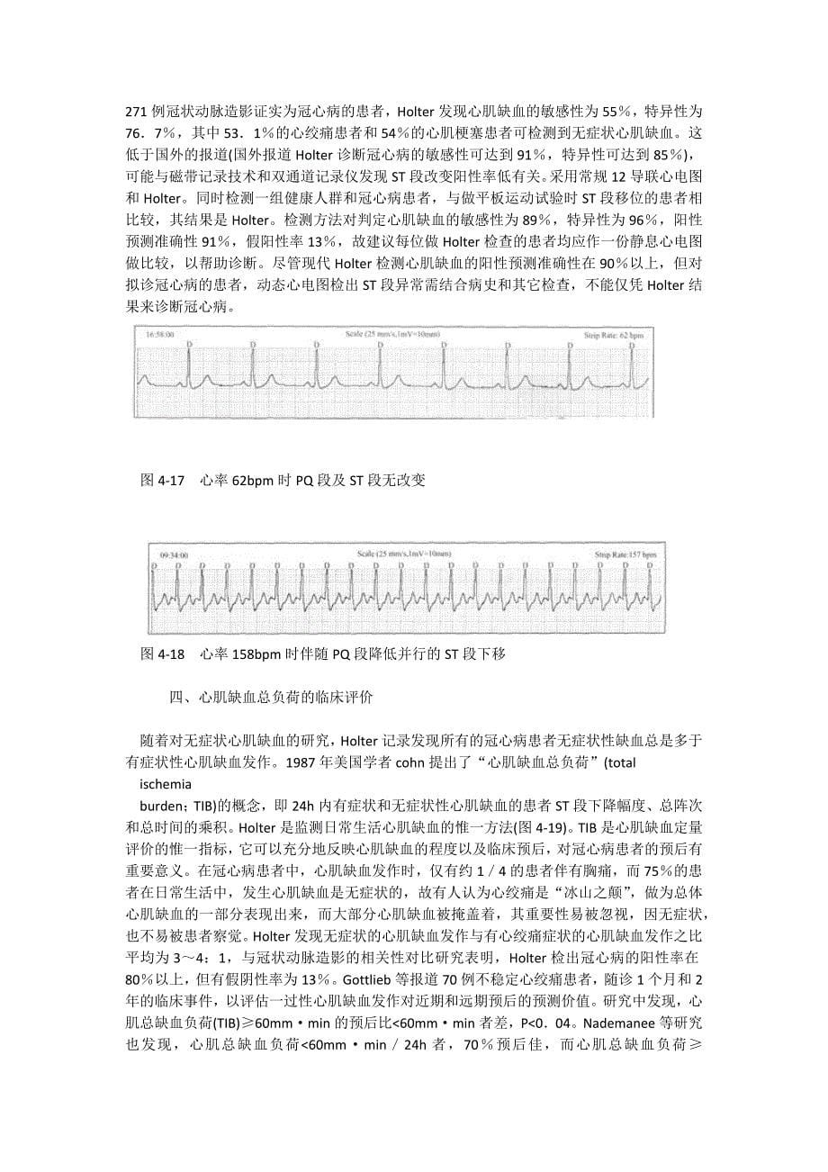 动态心电图的ST段分析_第5页