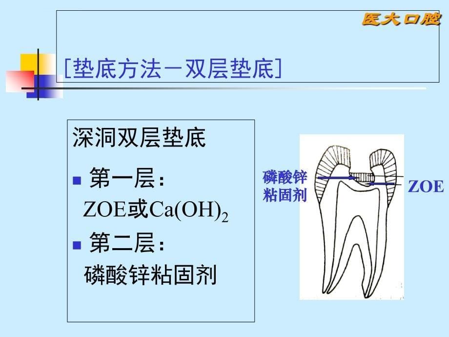 第3讲 龋病治疗课件_第5页