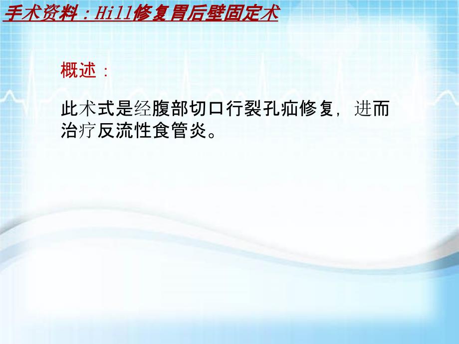 外科手术教学资料：Hill修复胃后壁固定术讲解模板_第4页