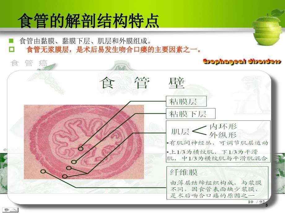 食管癌护理查房（课堂PPT）_第5页