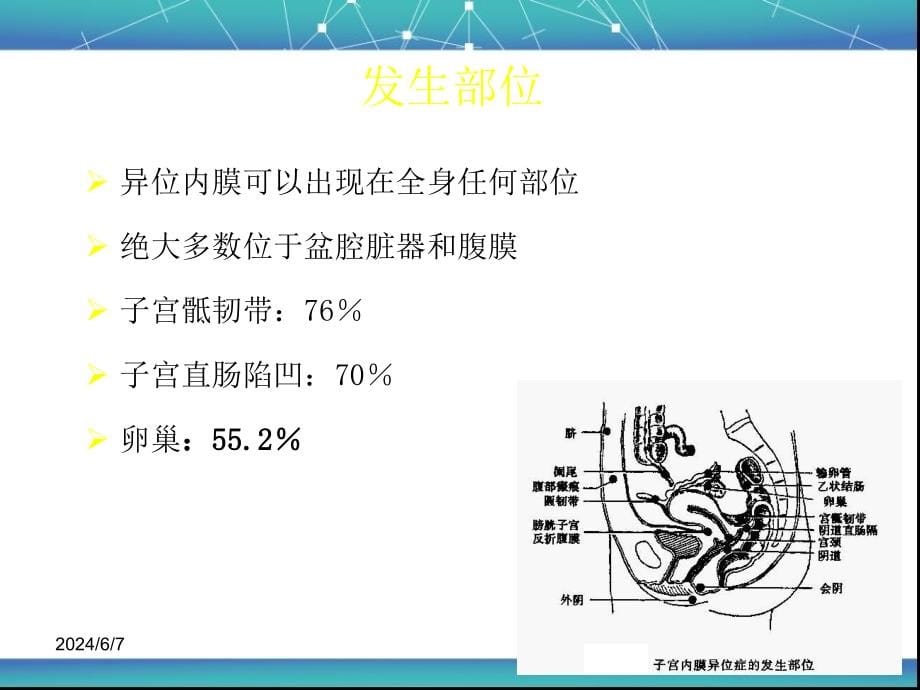 子宫内膜异位症、子宫腺肌症PPT_第5页