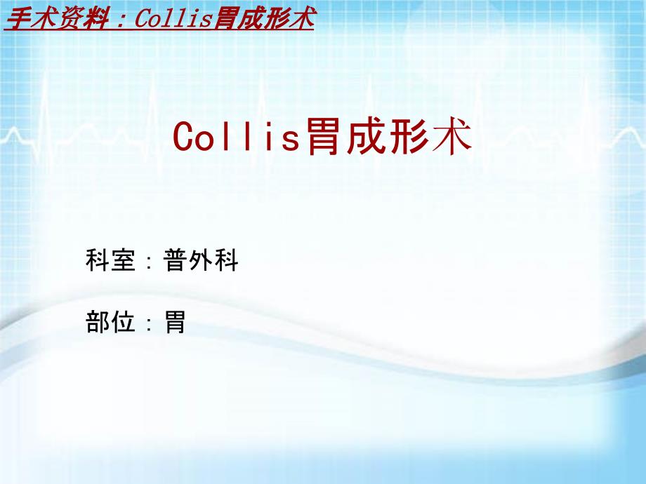 外科手术教学资料：Collis胃成形术讲解模板_第2页