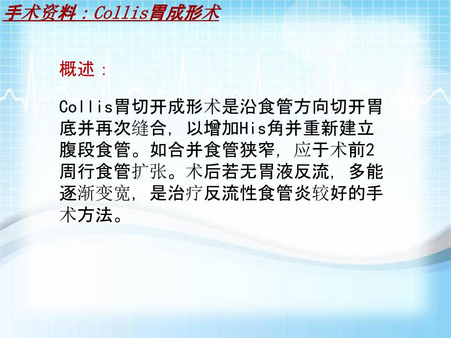 外科手术教学资料：Collis胃成形术讲解模板_第4页