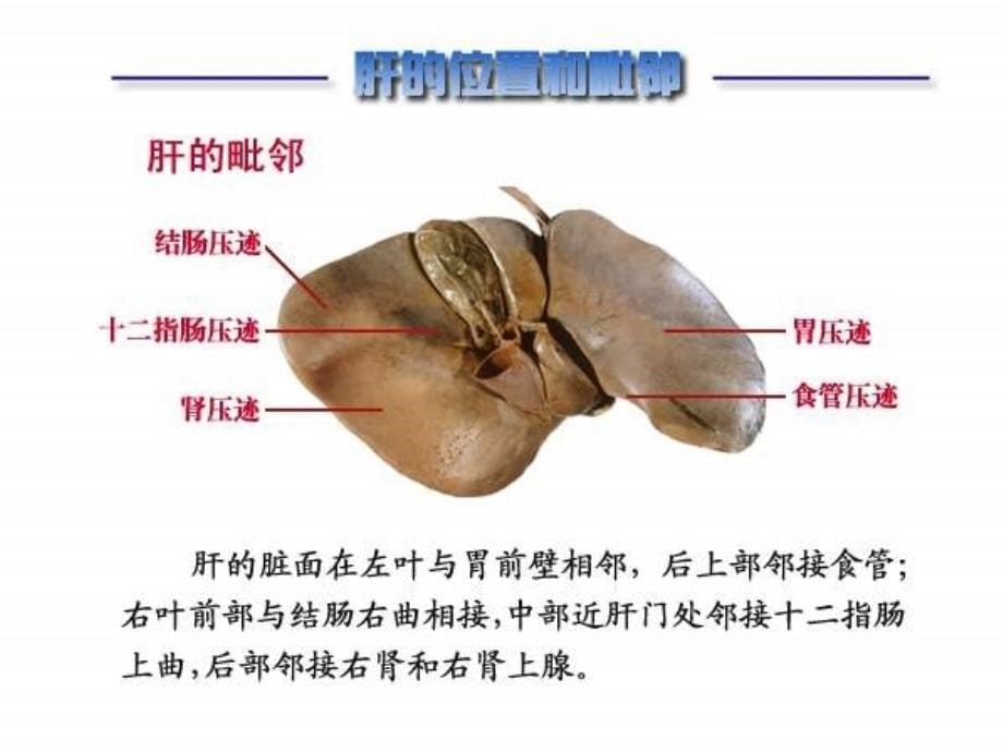 肝硬化课件ppt12_第5页