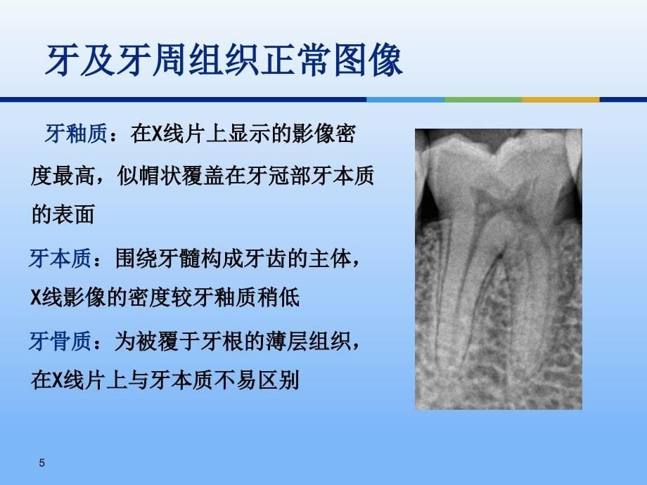 牙体牙周正常解剖及常见病X线表现（课堂PPT）_第5页