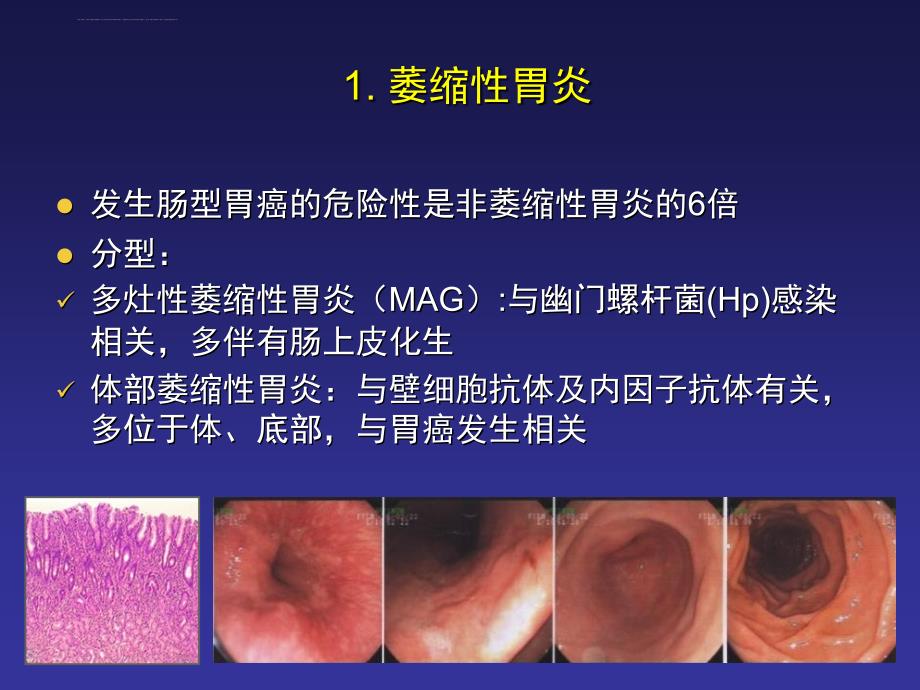 胃内癌前病变的诊断进展-周丽雅课件_第3页