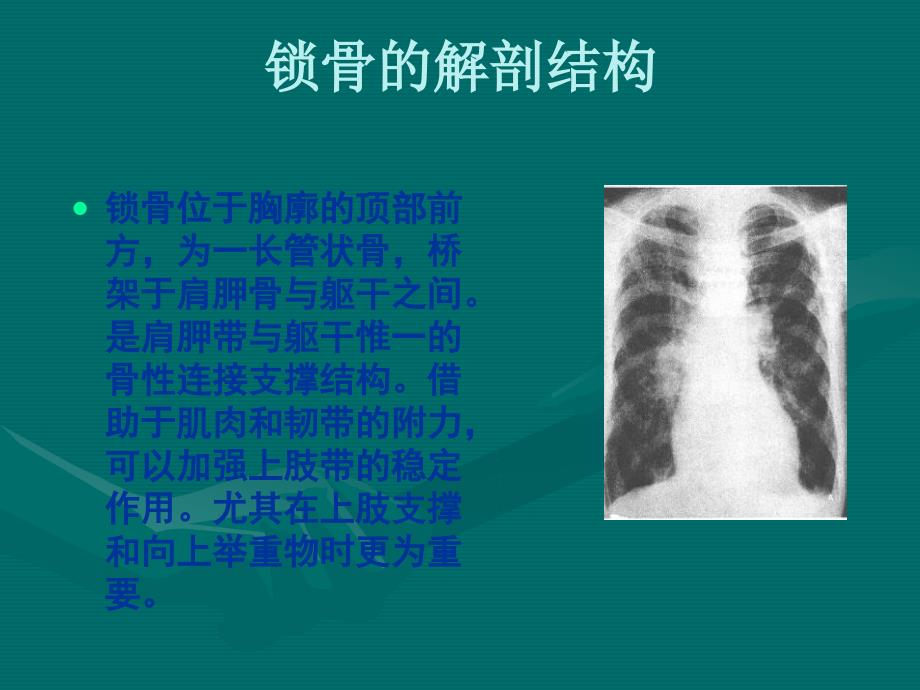 锁骨骨折的护理PPT课件01_第2页