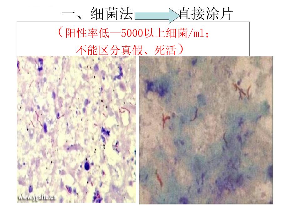 结核病的实验室诊断技术及应用课件_第4页