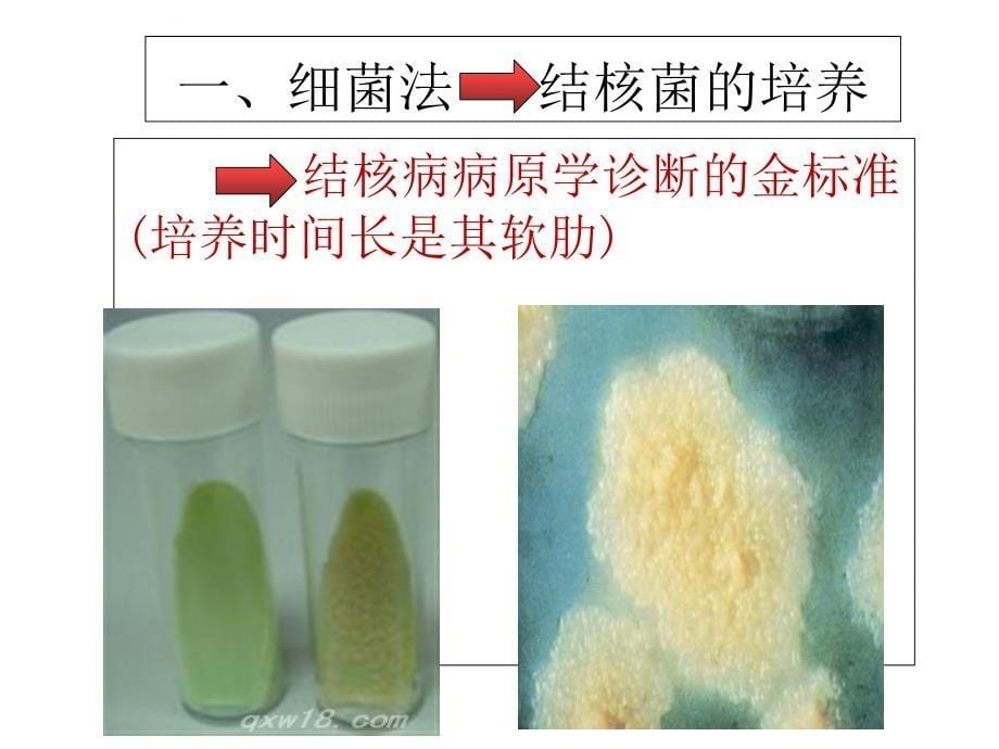 结核病的实验室诊断技术及应用课件_第5页