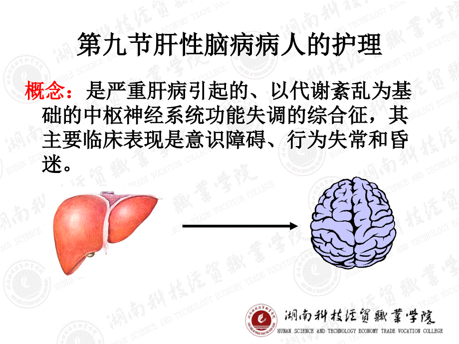 肝性脑病的护理（课堂PPT）_第2页