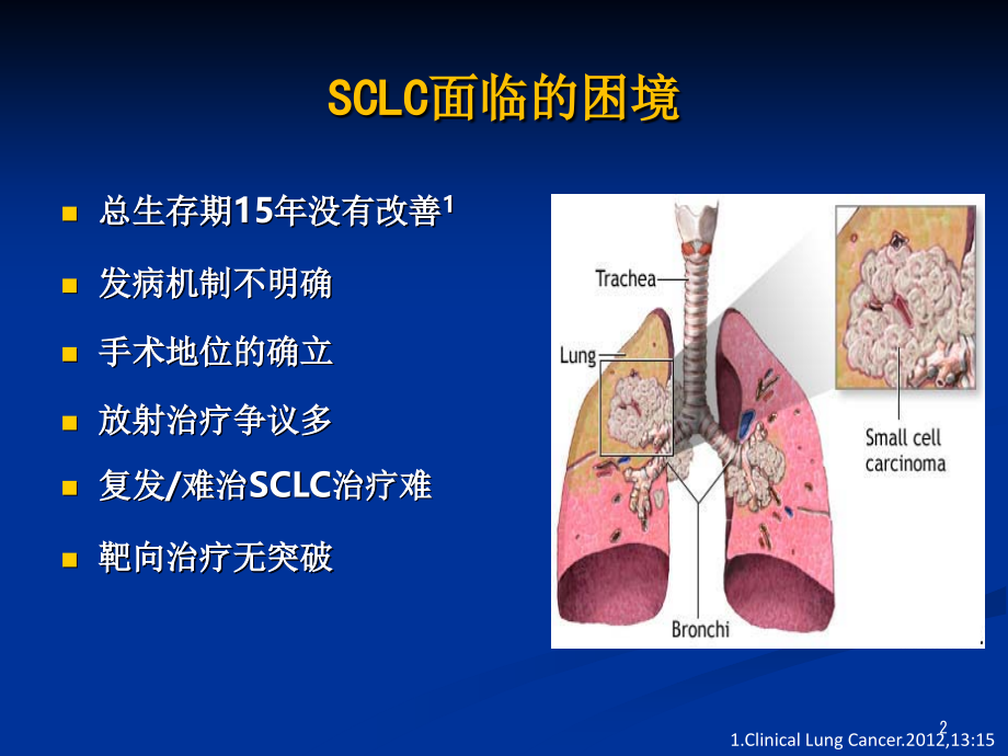 CSCO小细胞肺癌解读（课堂PPT）_第2页