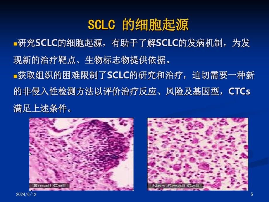 CSCO小细胞肺癌解读（课堂PPT）_第5页